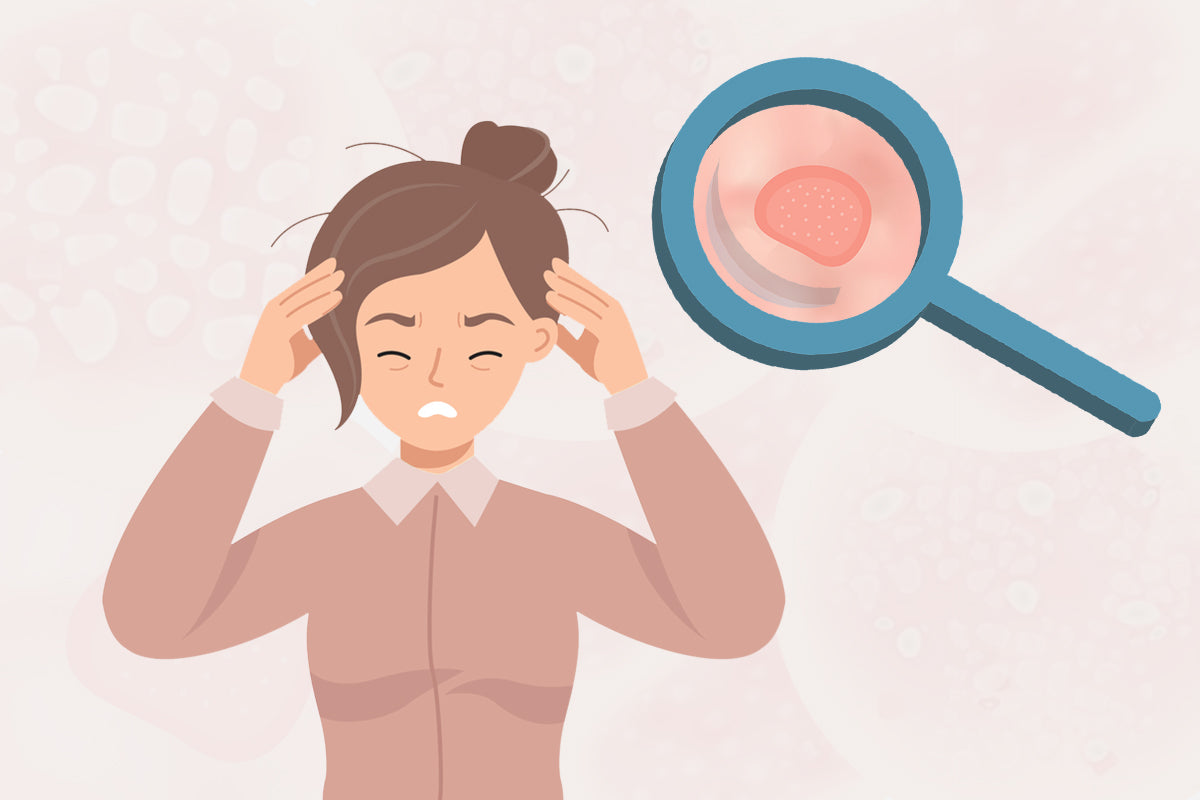 5 Scalp Infections: Causes, Symptoms, Preventions.