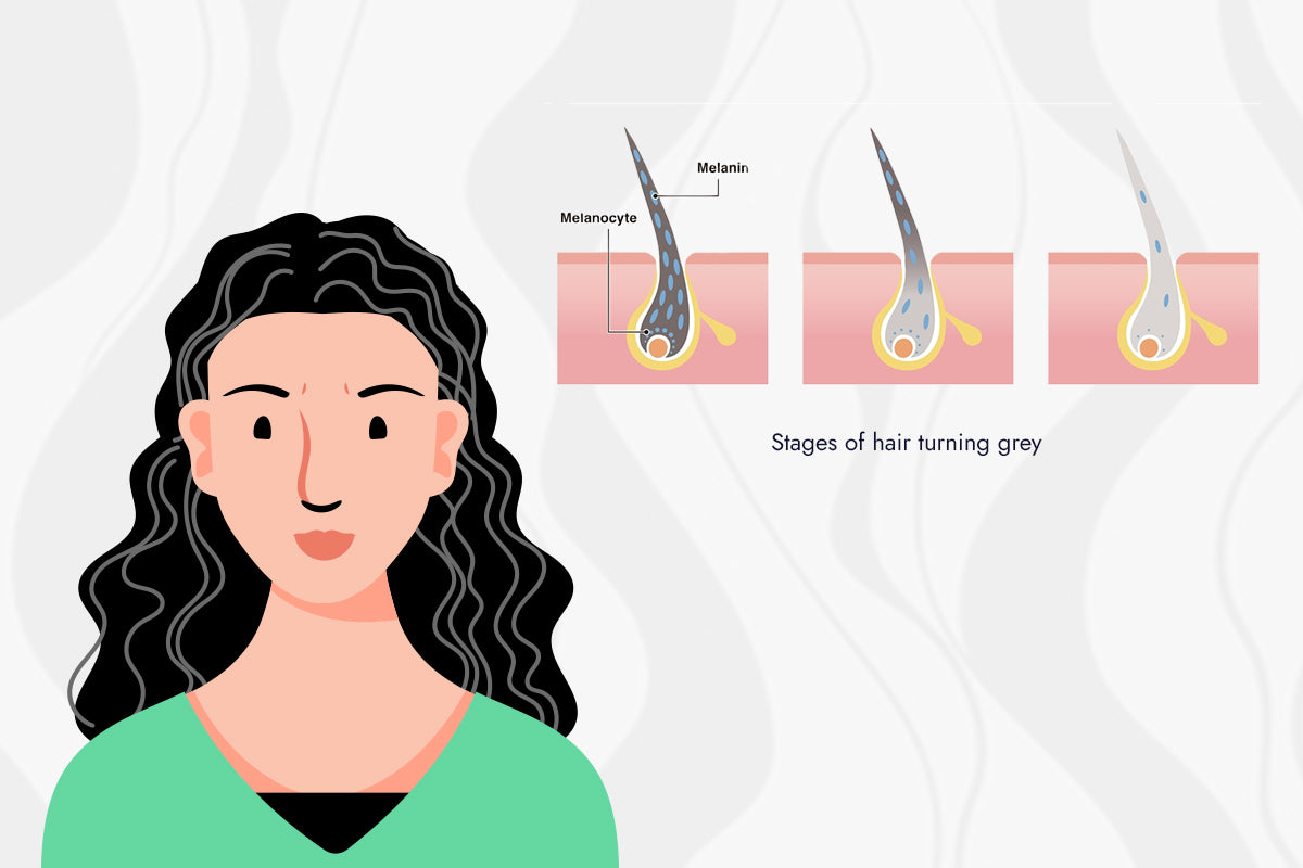 What is Premature Greying? Causes & Prevention